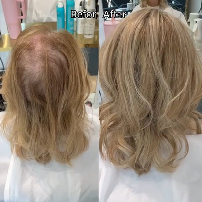 💖 Final Hours –🌷2026 New Lightweight & Breathable Wavy Hair Topper